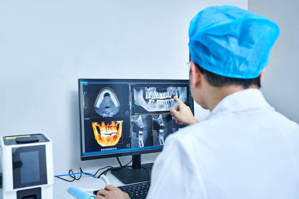 Best Emergency Wisdom Teeth Removal in Brickerville, PA
